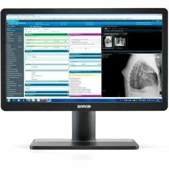 Barco Eonis MDRC-2422 22" Class Full HD LED Monitor - 16:9 - White