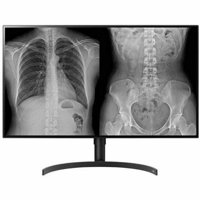 LG 32" (16:9) Uhd Nano Ips Led, 3840X2160, 5MS, Hdmi, DP, PBP, Dicom, H/Adj, Vesa, 3YR