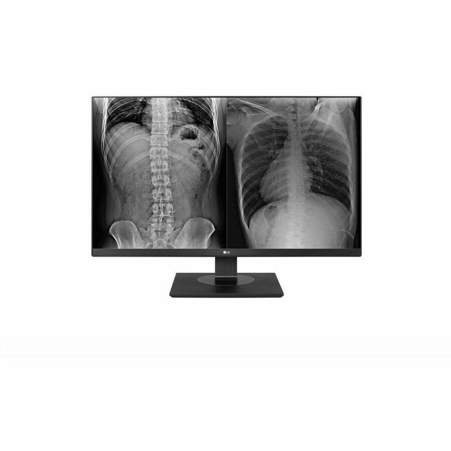 LG 27" (16:9) Uhd Ips Led, 3840X2160, 14MS, Hdmi(2), DP, SRGB-99 , Dicom, H/Adj, Tilt, 3YR