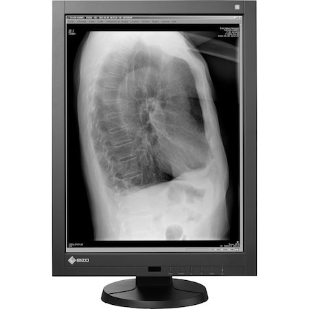 EIZO RadiForce GX240-CL-P 21" Class UXGA LCD Monitor - 4:3 - Black