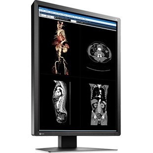 EIZO RadiForce MX216-BK 21" Class LCD Monitor - 3:4 - Black