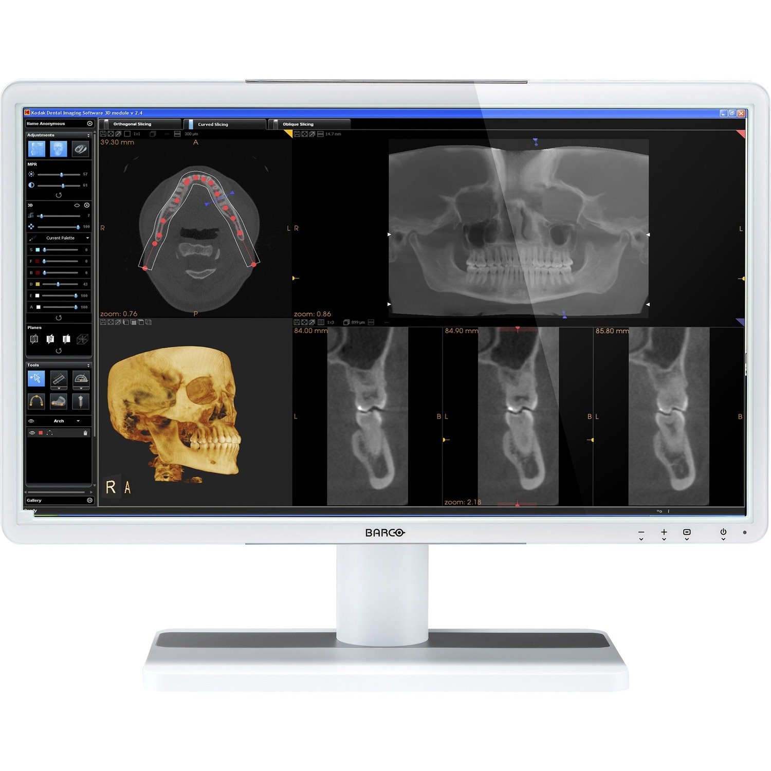 Barco MDRC-2222 Option WP 22" Class Full HD LCD Monitor - 16:9