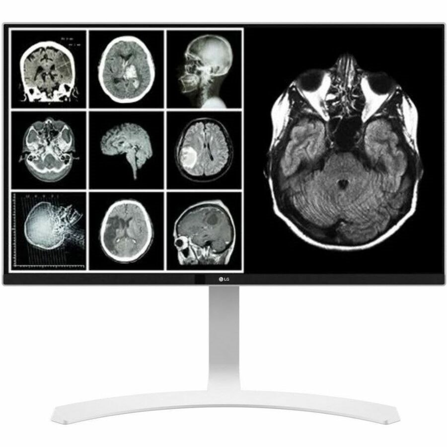 Lenovo 78094615 32" Class 4K UHD LED Monitor - 16:9 - Black