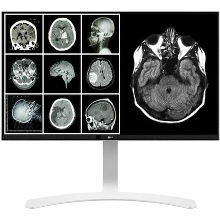 Lenovo 78094615 32" Class 4K UHD LED Monitor - 16:9 - Black