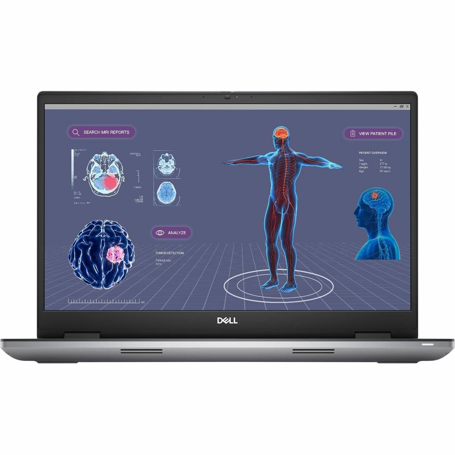 Dell Precision 7000 7780 17.3" Clamshell Mobile Workstation - Intel Core i9 13th Gen i9-13950HX - 32 GB - 2 TB SSD - Aluminum Titan Gray