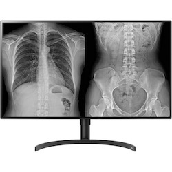 LG 32HL512D-B 32" Class 4K UHD LCD Monitor - 16:9 - TAA Compliant