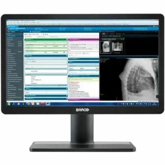 Barco Eonis MDRC-2422 22" Class Full HD LED Monitor - 16:9 - White