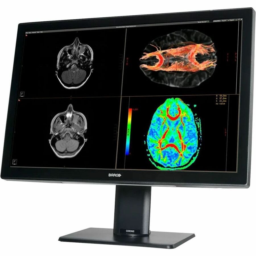 Barco Coronis Fusion MDCC&acirc;&euro;'6530 30" Class WQSXGA LED Monitor - 16:10 - Black, White