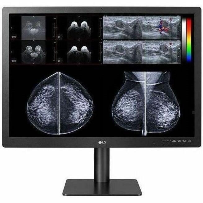 LG 31" (3:2) 12MP Ips Diagnostic, 4200X2800, 14MS, DP, Usb, H/Adj, Vesa, 5YR