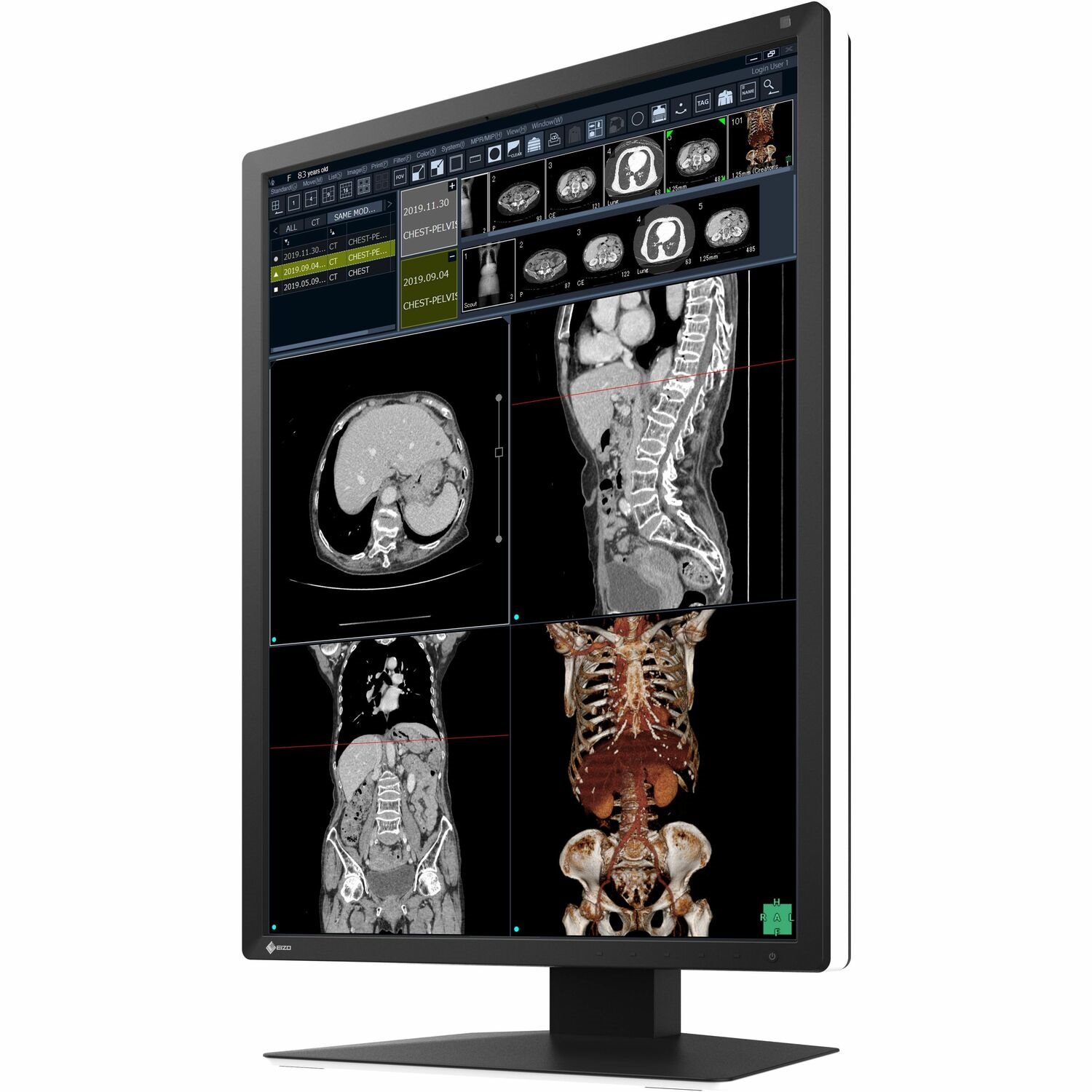 EIZO RadiForce RX270 21" Class WUXGA LED Monitor - 3:4 - Black, White