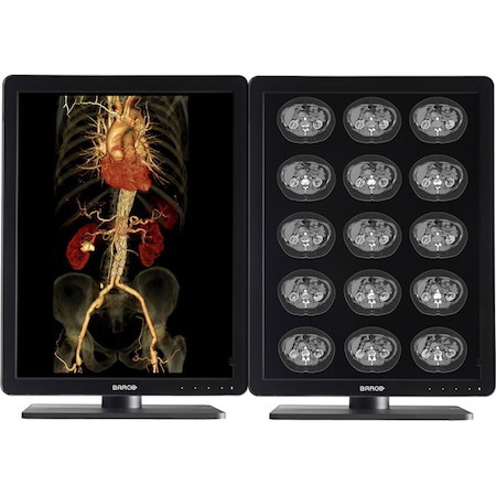 Barco Nio Color MDNC-3421 21" Class QXGA LCD Monitor - 4:3