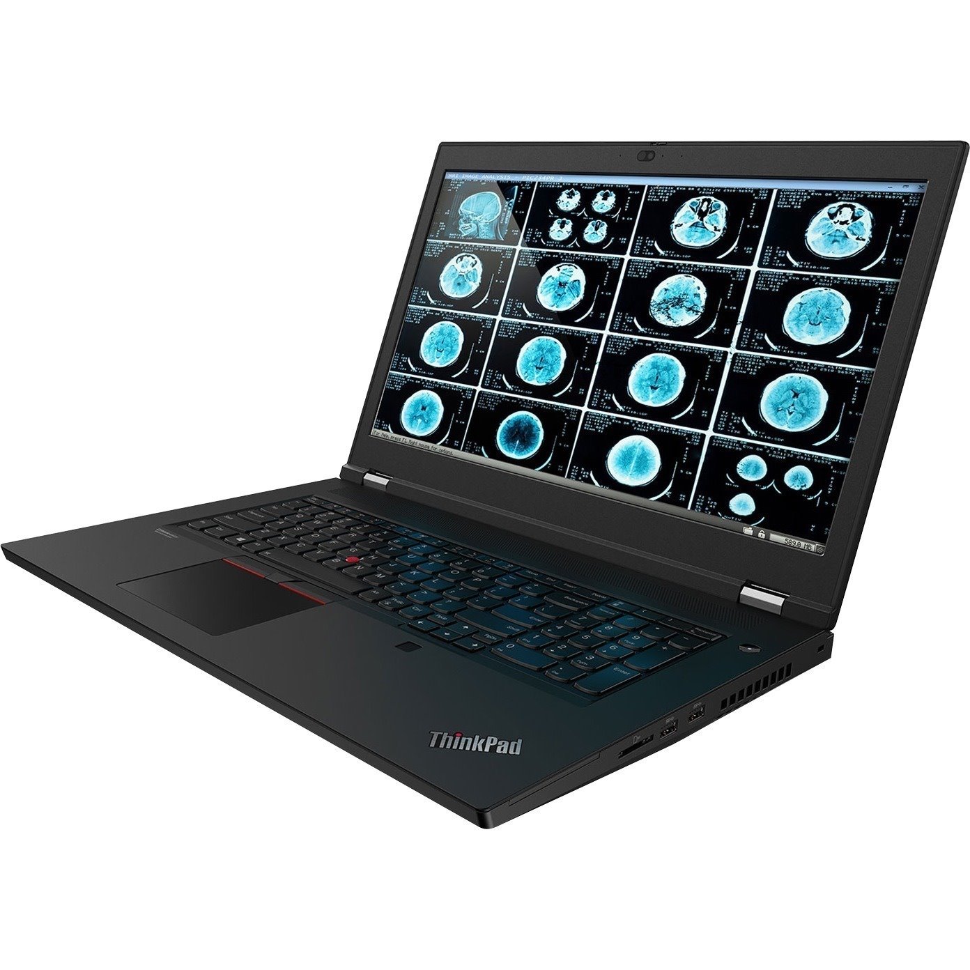 Lenovo ThinkPad P17 Gen 1 20SN004UUS 17.3" Mobile Workstation - Full HD - Intel Core i7 10th Gen i7-10850H - vPro Technology - 32 GB - 1 TB SSD - English (US) Keyboard - Black