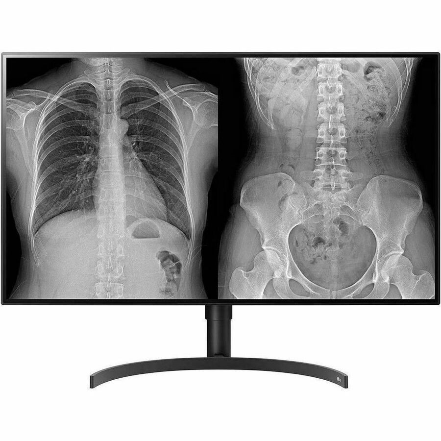 LG 32HL512D-M 32" Klasse 4K UHD LCD-monitor - 16:9