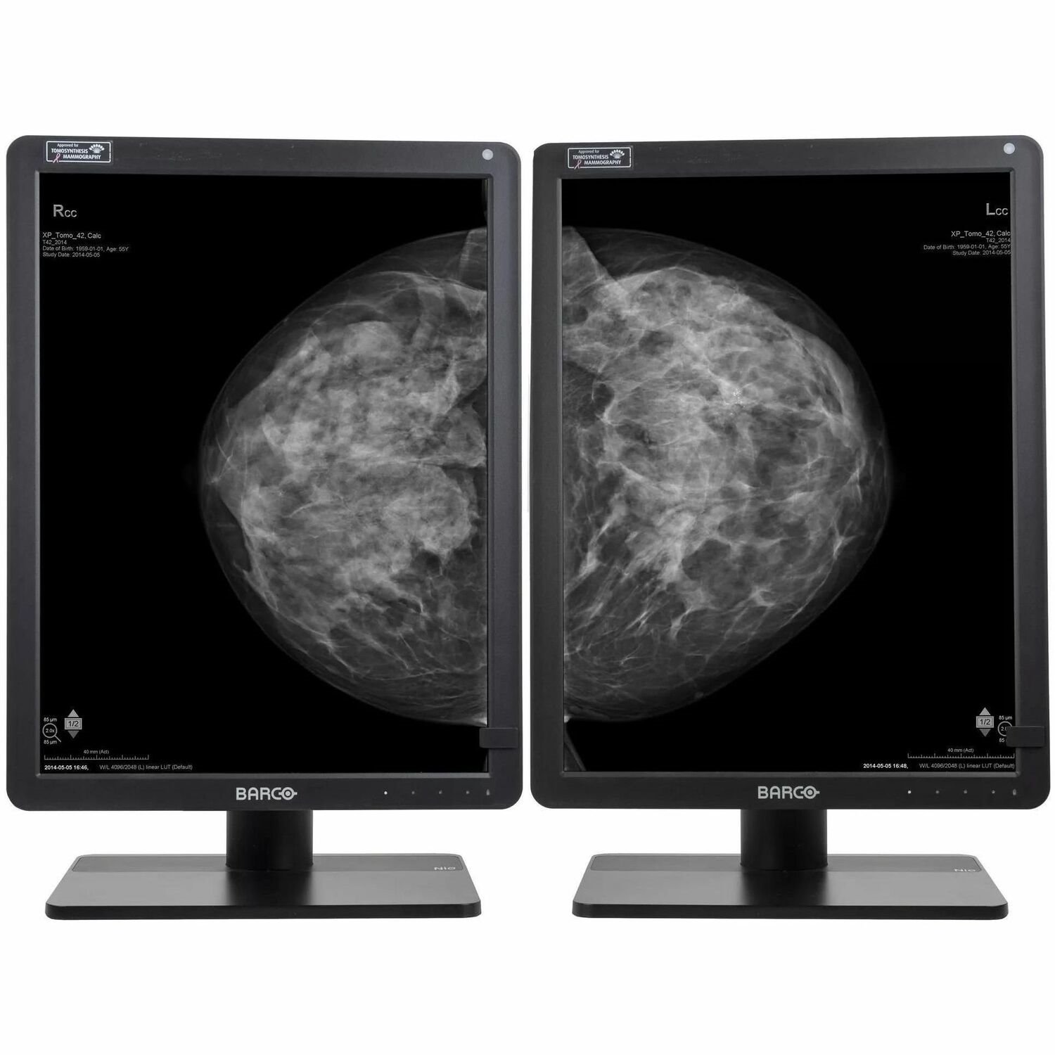 Barco Nio Gray MDNG-6221 21" Class QSXGA+ LED Monitor - 3:2