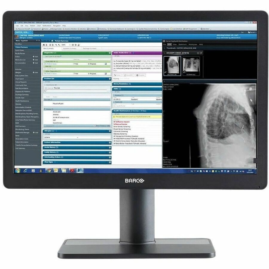 Barco Eonis C 2Mp-24In: 1 MDRC-2424 Color Review Display High Brightness- Protec