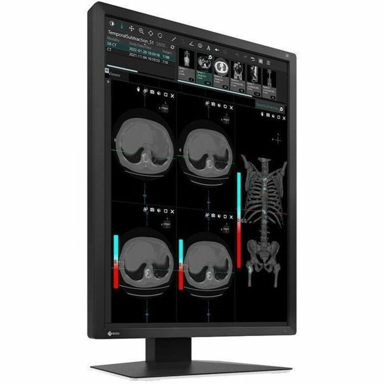 EIZO RadiForce MX217-BK 21" Class UXGA LED Monitor - 3:4 - Black