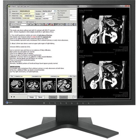 EIZO RadiForce MX194 19" Class SXGA LCD Monitor - 5:4 - Black