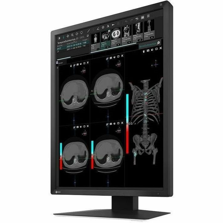 EIZO RadiForce MX217-BK 21" Class UXGA LED Monitor - 3:4 - Black