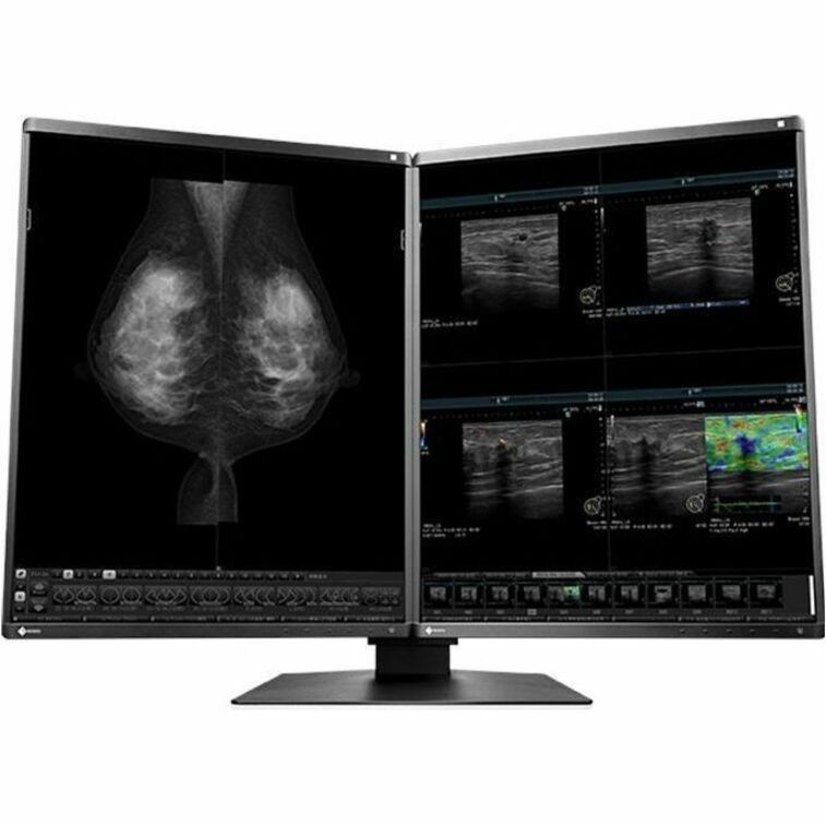 Eizo Radiforce 5MP 21.3 LCD Led