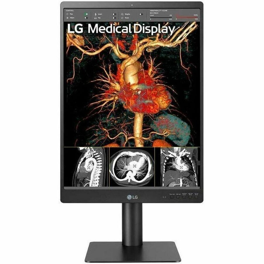 LG 21" 3MP IPS DIAGNOSTIC , 1100NITS, DP, USB, DVI, PIVOT, H/ADJ, 5YR