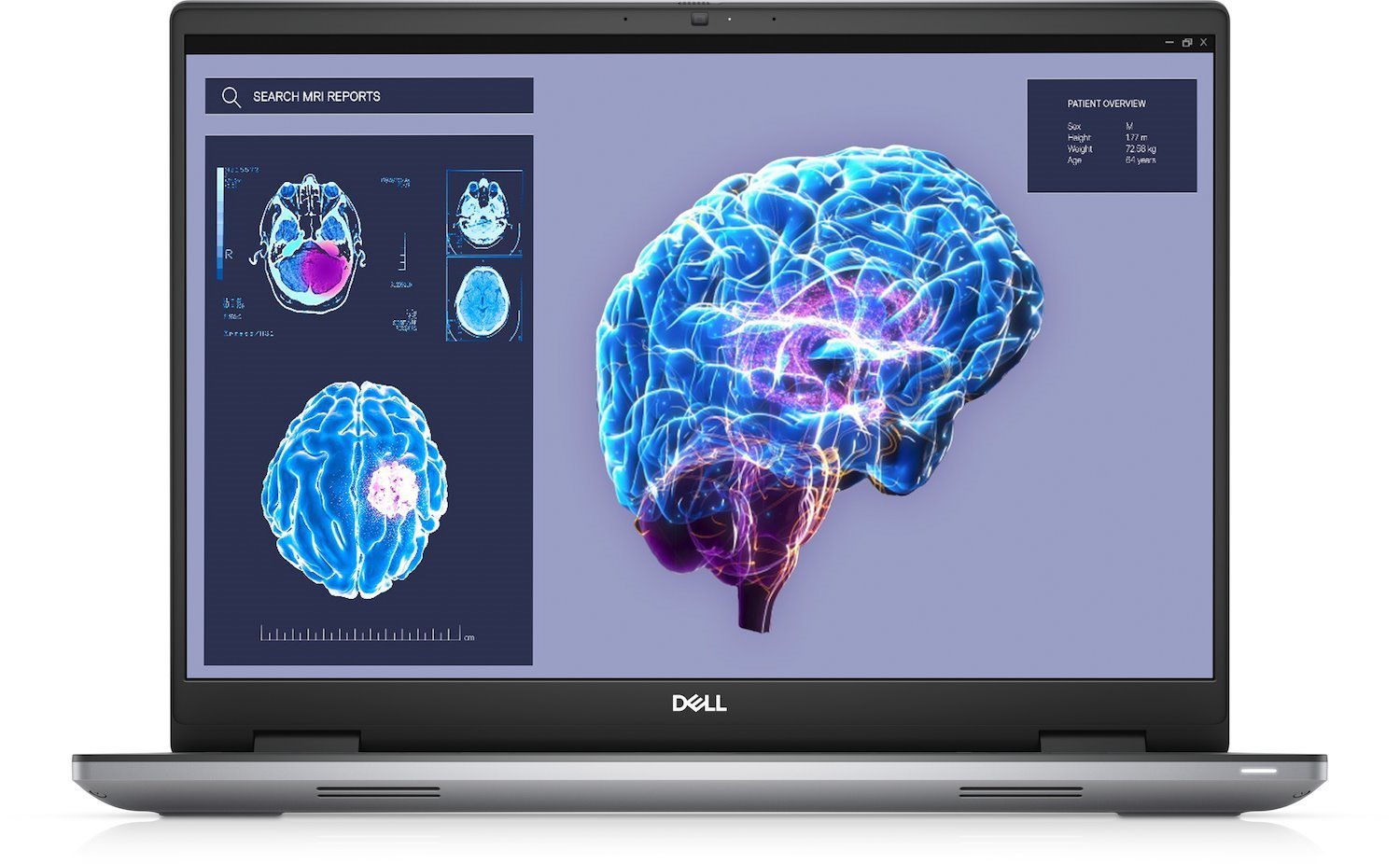Dell Precision 7680 - Intel Core I7 - 13850HX / Upp Till 5.3 GHz - Win 11 Pro - Nvidia RTX 2000 Ada - 32 GB Ram - 1 TB SSD NVMe, Class 40 - 16" 1920 X 1200 (Full HD Plus) - Gigabit Ethernet - Wi-Fi 6E