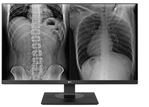 LG 27" (16:9) 8MP Ips Clinical, 350CD, Hdmi(2), DP, SRGB-99, Dicom, H/Adj, 3YR
