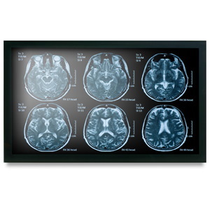 Onyx Meddp-622Hpn 21.5" Medical Touch Display